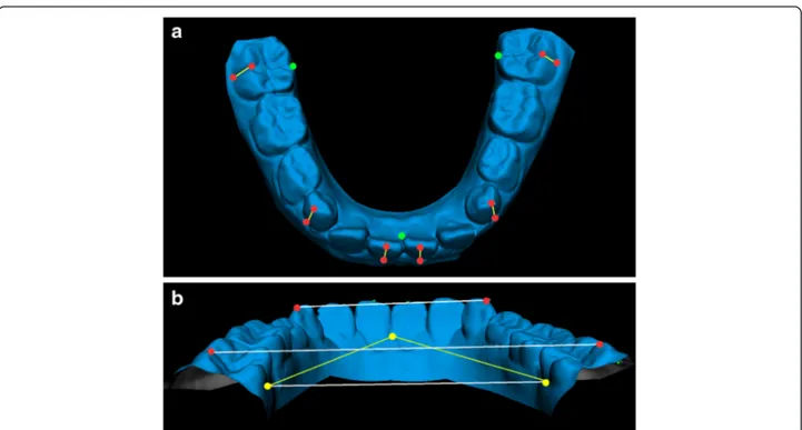 Fig. 1 a, b. Digital model of the mandible with markers: dental markers in red, reference plane markers in green