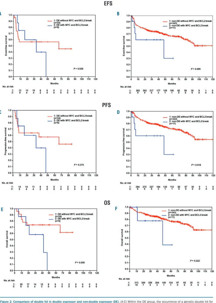 Figure 2. Comparison of double hit in double expressor and non-double expressor (DE).  (A-C) Within the DE group, the occurrence of a genetic double hit for MYC and BCL-2 (n=8 of 32, 25%) failed to confer a significant prognostic difference in EFS (P=0.628
