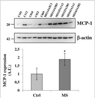 FigUre 7 | Monocyte chemoattractant protein-1 (MCP-1) chemokine is 
