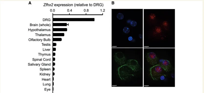 Figure 2 Zfhx2 is highly expressed in DRG within peripherin-positive neurons. (A) Real-time qPCR assay measuring the expression