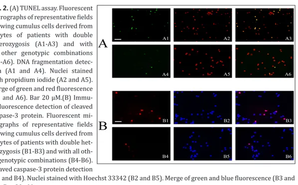 Fig. 2. (A) TUNEL assay. Fluorescent  micrographs of representative fields  showing cumulus cells derived from  oocytes  of  patients  with  double  heterozygosis  (A1-A3)  and  with  all  other  genotypic  combinations  (A4-A6)