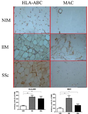 Figure 4 shows a transmission-electron-micros- transmission-electron-micros-copy (TEM) analysis of SSc muscle biopsies