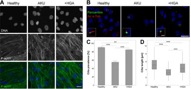 FIGURE 1 Alkaptonuria (AKU) alters articular chondrocyte F-actin cytoskeleton, and primary cilia prevalence and length
