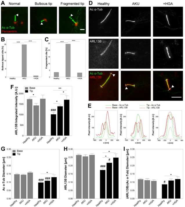 FIGURE 3 Cilia structure and Arl13b protein distribution are altered in Alkaptonuria (AKU) consistent with disrupted ciliary trafficking