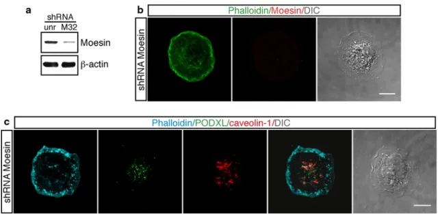 Fig. 6 Effects of Moesin silencing in endothelial cells during the early phases of adhesion