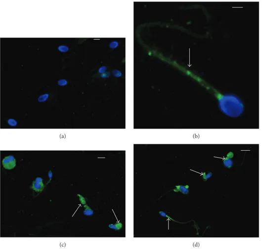 Figure 1: Immunocytochemical staining with polyclonal 8-iso-PGF 2 α antibody of sperm from fertile man (a), idiopathic infertile man