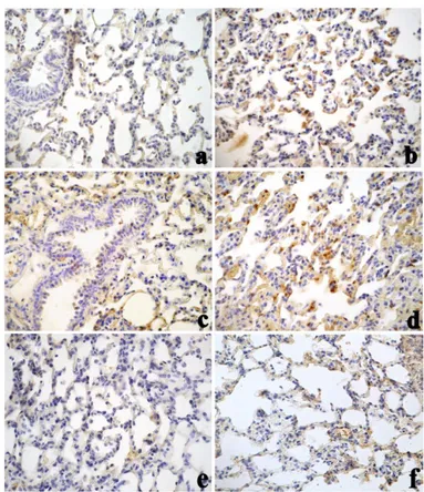 Fig.  3.  Immunostaining  pattern  of  SOD  1  expression  in  lung tissue in controls (a), 30 days after treatment with CdCl 2