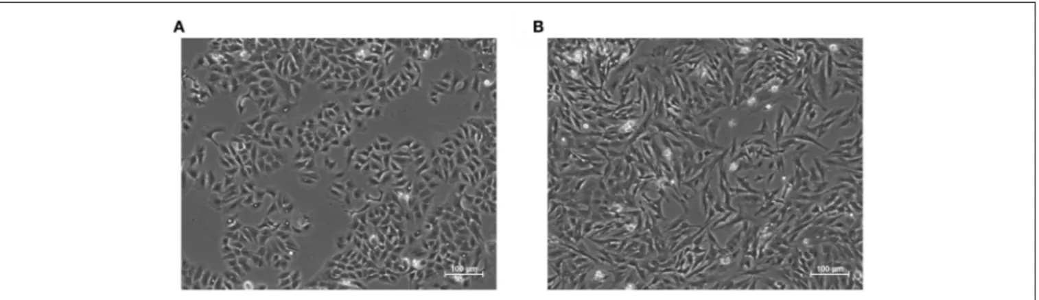 FIGURE 1 | Representative images of the epithelial (A) and mesenchymal (B) phenotypes in A549 cell line