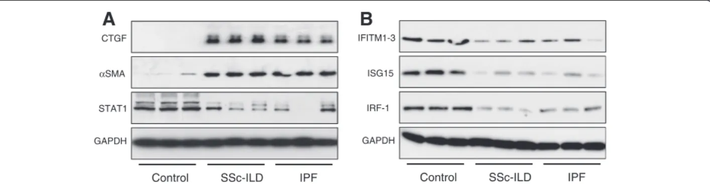 Figure 3 Western blot confirmation of microarray results. Protein expression levels of six significantly differently expressed genes selected from the microarray data were visualised by western blot in fibroblast samples independent to those used in the mi