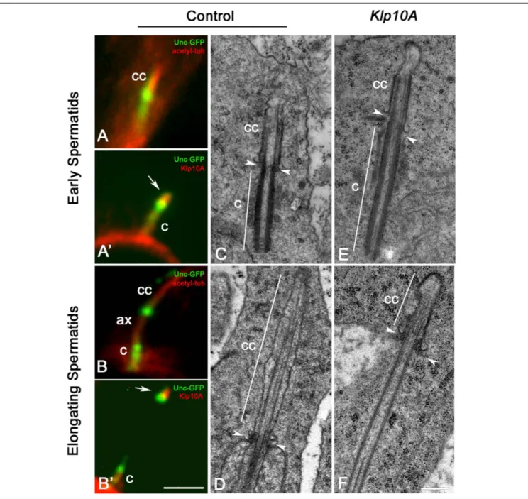 FIGURE 5 | The ciliary cap is shorter in elongating Klp10A spermatids. The intermediate dot-like Unc-GFP signal is localized at the base of the ciliary cap (cc) in young spermatids (A) and moves away as the sperm axoneme (ax) elongates (B)