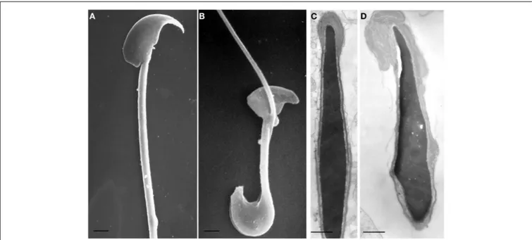 FIGURE 1 | Scanning (A,B) and transmission (C,D) electron microscopy micrographs of spermatozoa from wild type (A,C) and Twitcher (B,D) mouse, collected from vas deferens