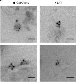 Fig. 1 GMAP210 is present in membranes puriﬁed from T lymphocytes and containing LAT. a JCAM2.5 LAT-deﬁcient T-cells expressing a chimeric mouse
