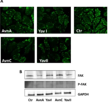 Figure 6. Effects of natural and yeast-derived avenanthramides on focal adhesion kinase (FAK)  expression and phosphorylation
