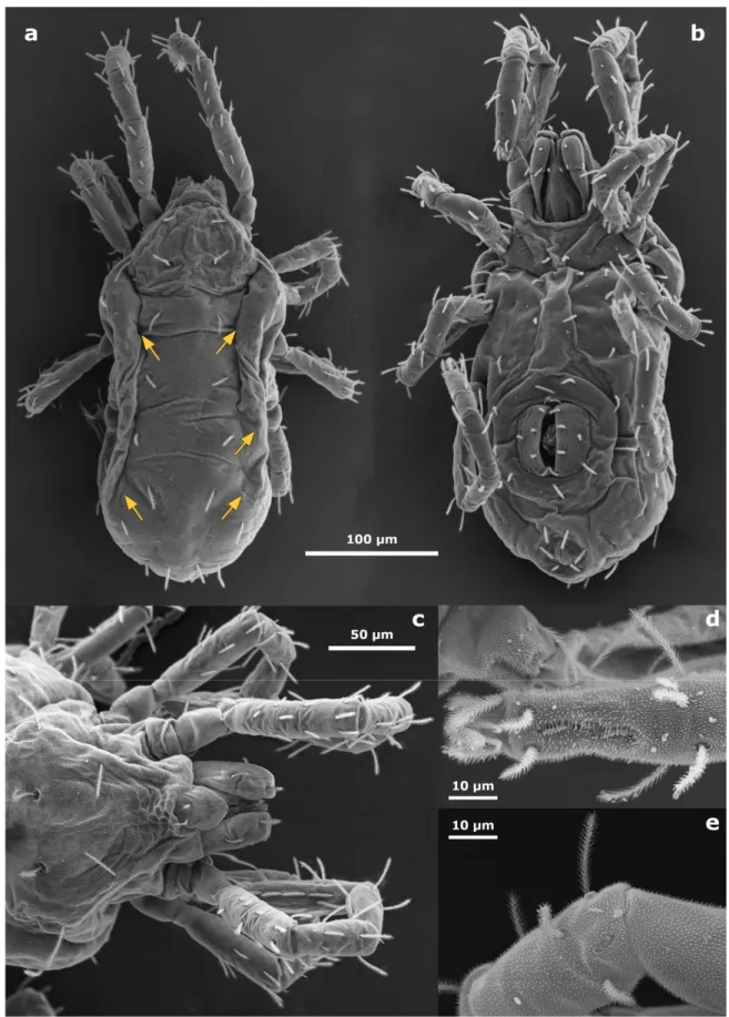 Figure 5. S. ineffabilis sp. nov. Scanning electron microscopy. (a) dorsal view, slit pores visible, indicated by orange arrows;  (b) ventral view with internal genital setae and asymmetry in the aggenital setae visible; (c) detail of the propodosoma,  epi