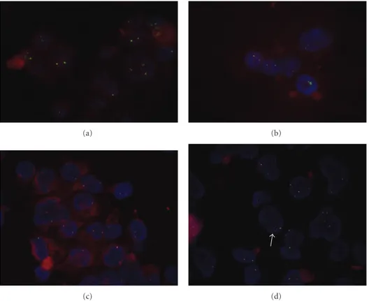 Figure 4: FISH analysis for BCL2 (a, b) and MYC (c, d) for untreated (a, c) and E. tirucalli-treated cells (b, d)