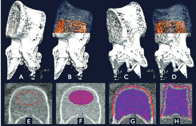 Fig. 1. 2D and 3D visualization of a vertebra imaged noninvasively by high ‐resolution quantitative computed tomography