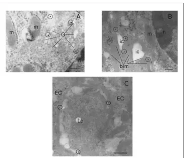 FigUre 2 | Morphological analysis of IL-12R β2 on IECs. Transmission  electron micrograph analysis (immunogold staining) of mouse small intestine  showed that IL-12R β2 in IECs was found in the Golgi (a) as well as the  basolateral membrane  (B) and at the