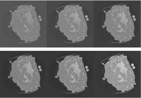 Figure 9.  Reconstructed slices for breast sample T3 at the different mean glandular doses