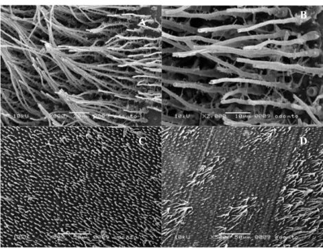 Fig. 2. Resin tags observed with self-etching adhesives. 2A: SEB dentin bonding interface (orig- (orig-inal magnification: SEM ×800); 2B: SEB dentin bonding interface