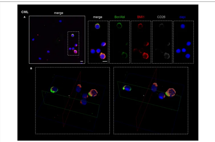 FIGURE 4 | Confocal laser scanning microscopy: representative images of a bone marrow smear from one of the 9 CML patients enrolled into the study