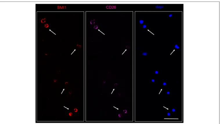 FIGURE 6 | Confocal laser scanning microscopy: representative images of a bone marrow smear from one of the 9 CML patients enrolled into the study with a high representation of CD26+ cells