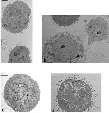 Figure 5. Transmission electron microscopy (TEM) sections of cultured HT-29 cells. (a) Baseline  conditions
