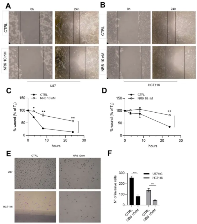 Figure 6. ALDH1A3 inhibitor is able to reduce migration and invasiveness in vitro. (A) Representative wound healing images of U87MG cells treated with vehicle and NR6 10 nM