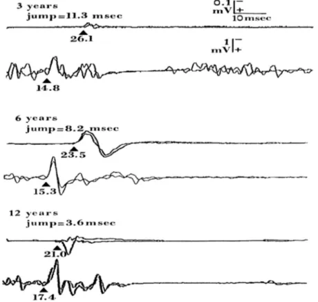 Fig. 8. Age effects on absolute latencies and ’latency jump’ between ‘‘relaxed’’ and ‘‘contracted’’ motor evoked potentials (from Caramia et al., 1993 – with permission)