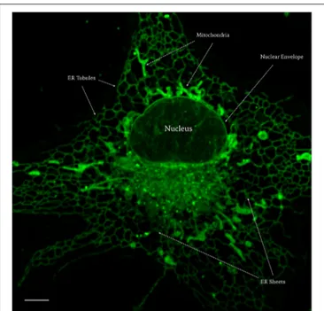 FIGURE 10 | Confocal live imaging of a LX2 cell stained with NRB-AF12 showing subcellular distribution of the fluorescent probe