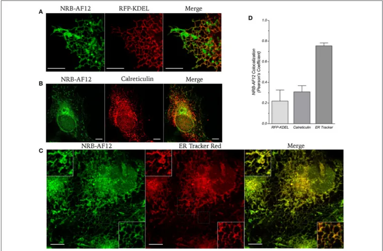 FIGURE 2 | (A) Live cell imaging of LX2 cells transfected with ER-reporter RFP-KDEL plasmid and subsequently stained with NRB-AF12