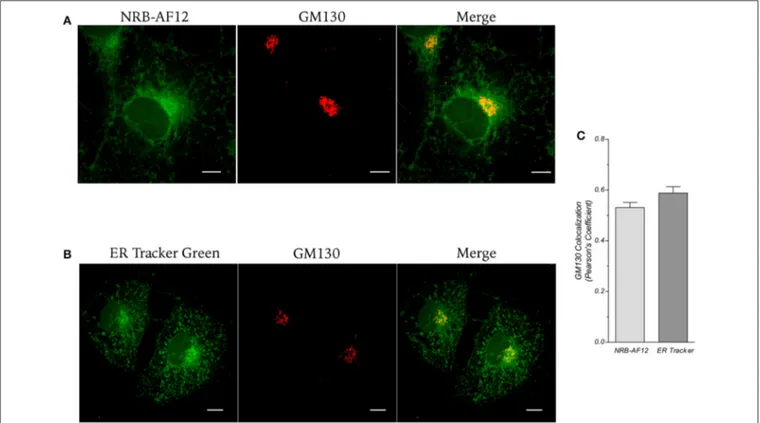 FIGURE 5 | LX2 fixed cells immunostained for the Golgi apparatus structural protein GM130; cells were counter-labeled with (A) NRB-AF12 or (B) ER-Tr green