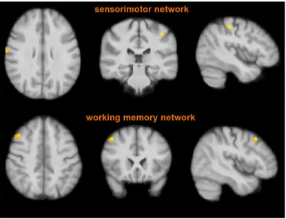 Figure 4. FC analysis of the two RSNs (sensorimotor and right working memory networks) where RIS subjects, similarly to NC,