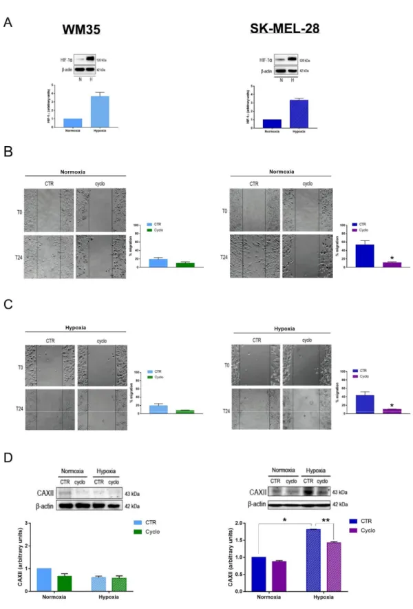 Figure 1. Inhibition of the Hedgehog pathway affects melanoma cell migration and CAXII protein expression