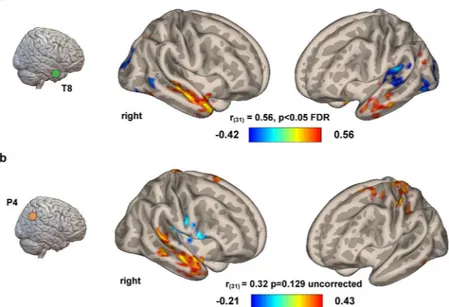 Figure 5.  Functional connectivity correlates at rest. Resting-state data collected in all the participants 