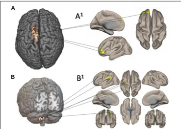 FIGURE 7 | Functional connectivity and cerebral blood flow (CBF) changes by using seed-to-voxel analysis