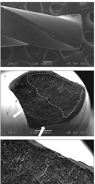 Figure 1. a-f. Scanning electron micrographs of the fracture surfaces of separated fragments after cyclic fatigue test in reciprocating OTR motion (left  column: a, b, c = F6 SkyTaper; right column d, e, f = OneShape)