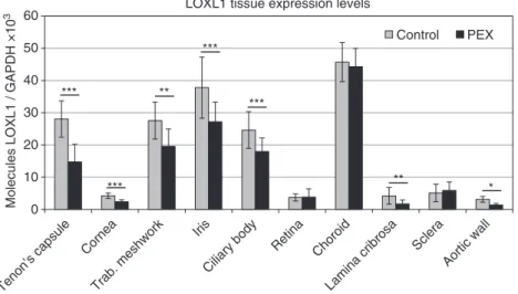Figure 4 | Determination of pathophysiologically relevant tissues and cell types. Expression of LOXL1 mRNA in ocular and extraocular tissues derived from normal human donors (control) and donors with manifest PEX syndrome using real-time PCR technology