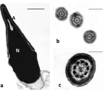 Figure 1.  TEM micrographs of normal sperm. (a) longitudinal section of a sperm head: the nuclear shape is 