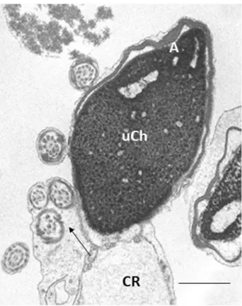 Figure 2.  TEM micrograph of longitudinal section of an immature sperm. The acrosome (A) is anomalous in 