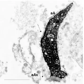 Figure 4.  TEM micrograph of longitudinal section of necrotic sperm characterized by disrupted chromatin 