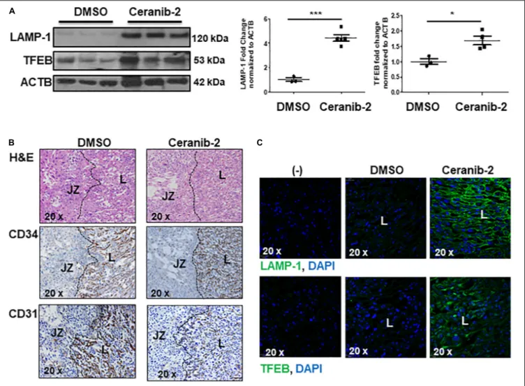 FIGURE 4 | Inhibition of acid ceramidase with Ceranib-2 in pregnant mice increases placental lysosomal biogenesis (A) Representative WB for LAMP-1 and TFEB and corresponding densitometry in placental lysates from CD1 mice injected with ceranib-2 or DMSO ve