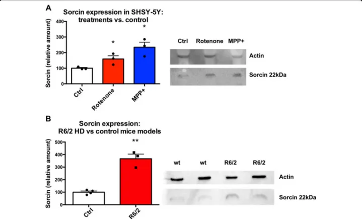 Fig. 5 Sorcin expression in neurodegenerative diseases models. A Sorcin expression levels in SH-SY5Y cells upon 48 h treatment with MPP + and Rotenone, vs