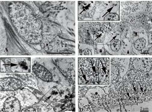 Figure 2. Images obtained by transmission electron microscopy (TEM) of M. galloprovincialis gill  biopsy exposed to NPs