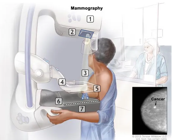 Figure 1.3: (a) Mammography apparatus : (1) anode, (2) filter, (3) X-rays, (4) compression plate, (5) scattering, (6) grid, (7) receptor.