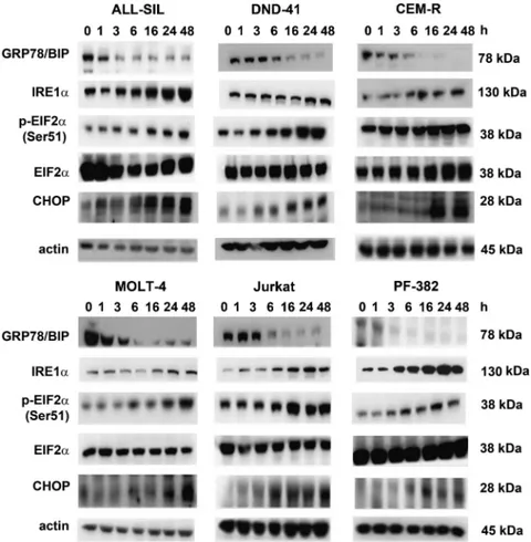 Figure 3. CX-4945 modulates ER stress/UPR signaling in T-ALL cell lines. Western blot analysis documenting the time-dependent modulation of ER stress/UPR signaling markers induced by CX-4945 (5 m M ) in T-ALL cell lines
