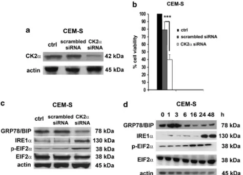 Figure 4. CK2a downregulation by siRNA affects CEM-S cell viability and modulates ER stress/UPR signaling