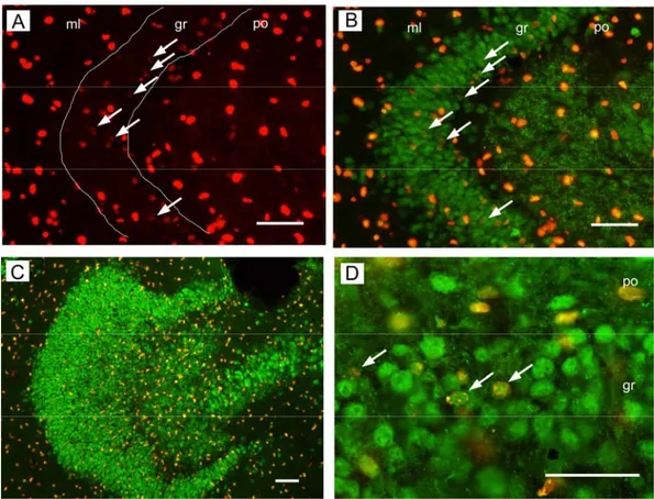 Fig. 6 . Fluorescent immunohistochemistry for BrdU/NeuN in organotypic  culture of postnatal mouse hippocampal slices, indication of spontaneous  neurogenesis and proliferation of cells in the dentate gyrus at DIV 14