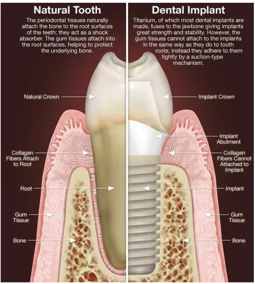 Fig.  2 Some  examples  of  dental  implant  macroscopic  design  and  surfaces. 