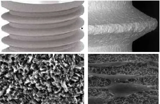 Fig. 12 . One of the dental implant surface used in 3 of the reported studies:  ZirTi  surface  (Sweden  &amp;  Martina,  Due  Carrare,  Padova  IT),  obtained  by sand-blasting  with  zirconium  oxide  and  subsequent  acid  etching  with  mineral acids.