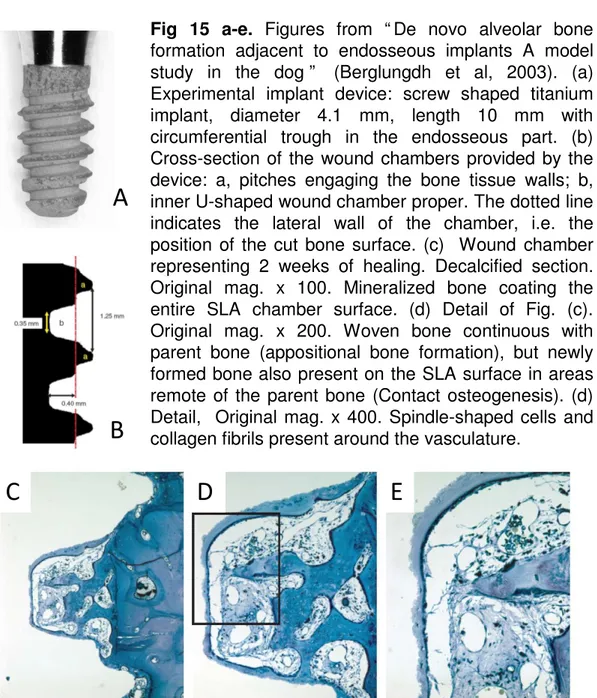 Fig. 14 .  Cascade of  events related  to new bone  formation on a  dental implant  surface  (Berglundh et  al, 2003)